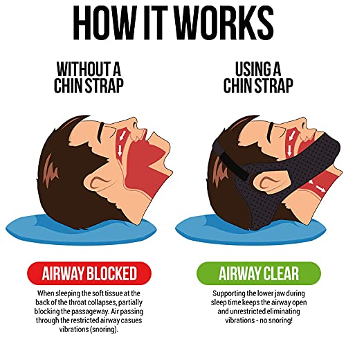 Anti Snoring Chin Strap, Large, Adjustable A2708